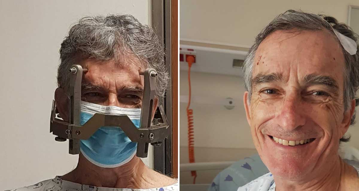 אמיר קולבן לפני ואחרי הניתוח. צילום: ליאור צור