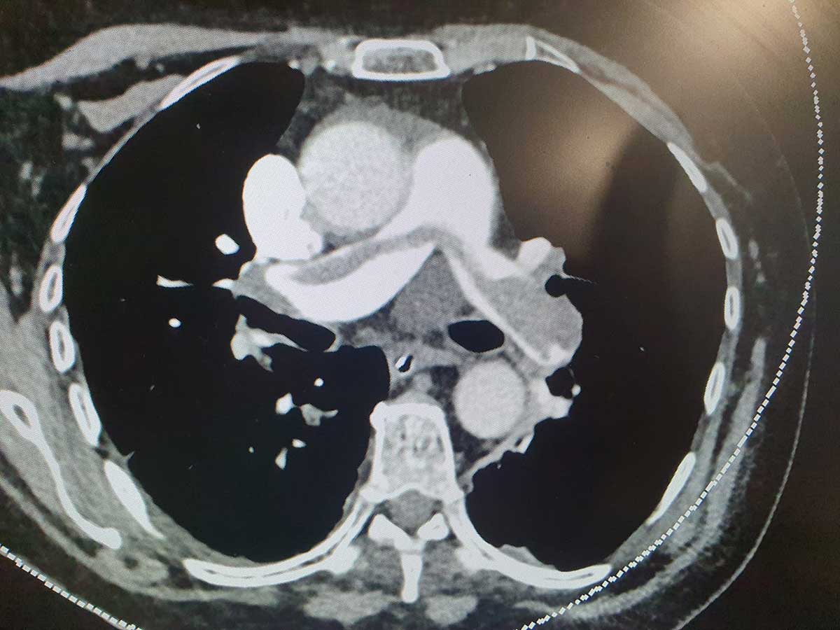 ביצוע השאיבה. צילום: שערי צדק