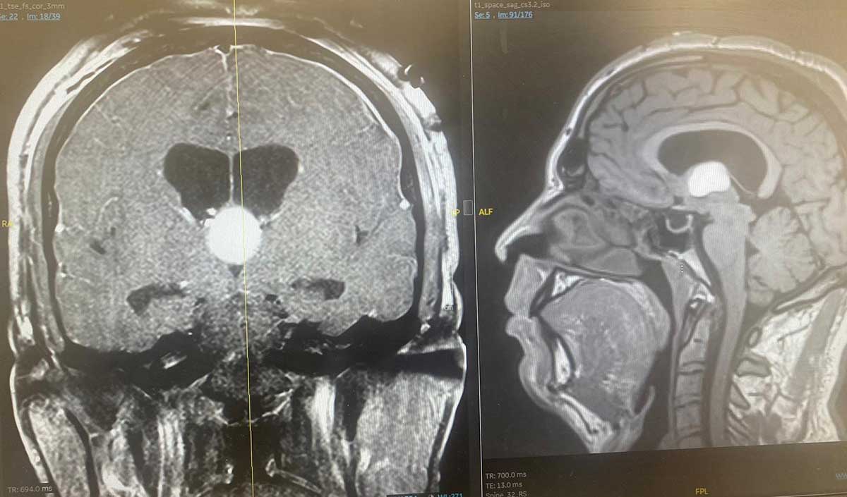 הדמיית הגידול. צילום: שערי צדק